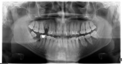 Pano2 ykqkuj - Eugenol