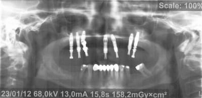 Pano 1 sdjwoa - Eugenol