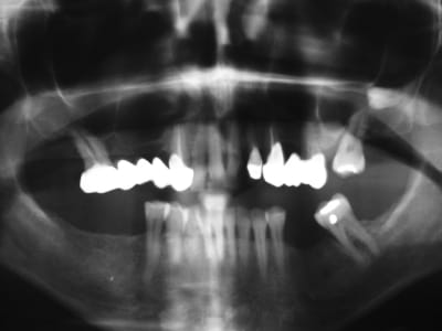 Pano rd7x1h - Eugenol