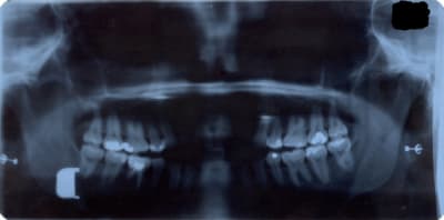 Panoramique2 ohnf16 - Eugenol