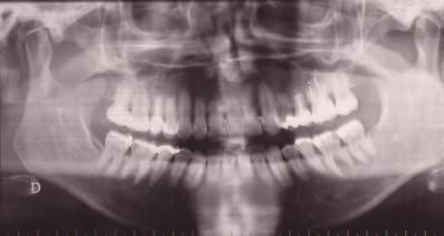 Photo 001 hyovks - Eugenol