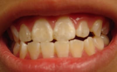 Photo 005 quhpu1 - Eugenol