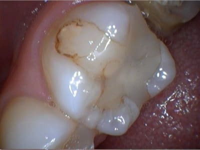 Photo 1 wyadl9 - Eugenol