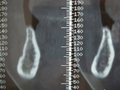 Photo 2752 v7jm36 - Eugenol