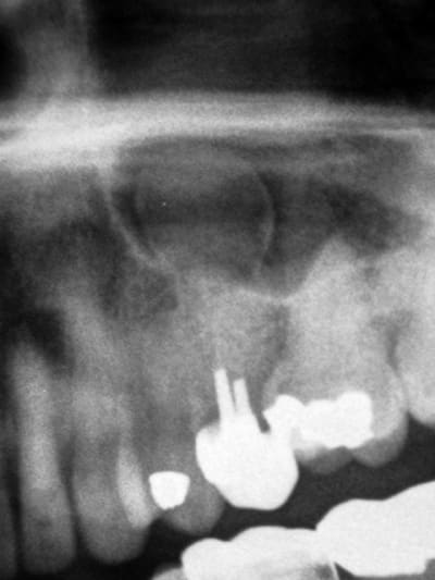 Photo amy2cb - Eugenol