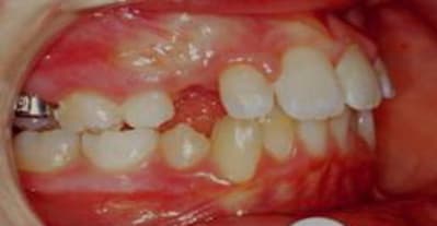Picture1 d at4kao - Eugenol