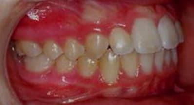 Picture2 d nvazlb - Eugenol
