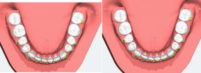 Pinnn maps0g - Eugenol