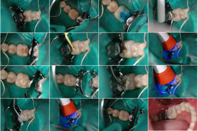 Planche contact 001 nyznmg - Eugenol