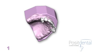 Positdental mci mise en charge immédiate 001 xory0q - Eugenol