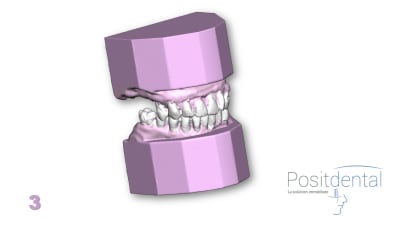 Positdental mci mise en charge immédiate 003 rs7a4c - Eugenol