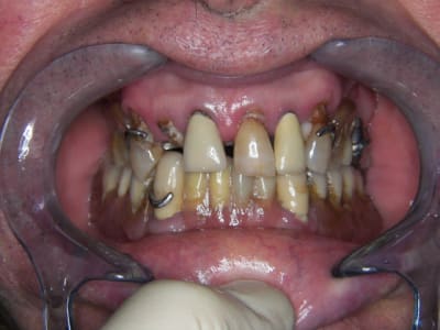 Q pre op 2  g5cquc - Eugenol