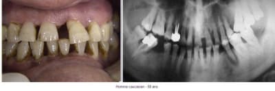 Question pour expert irmrza - Eugenol
