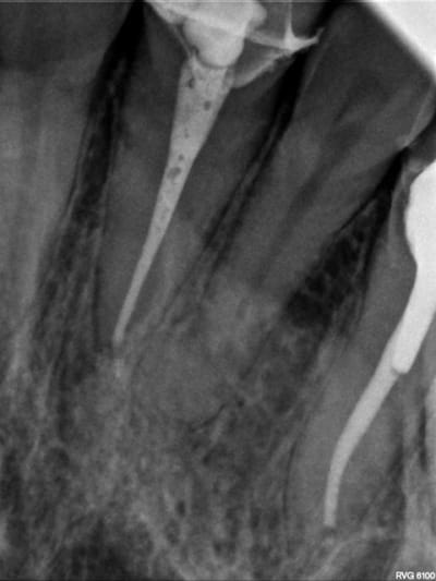 R12 wpibof - Eugenol