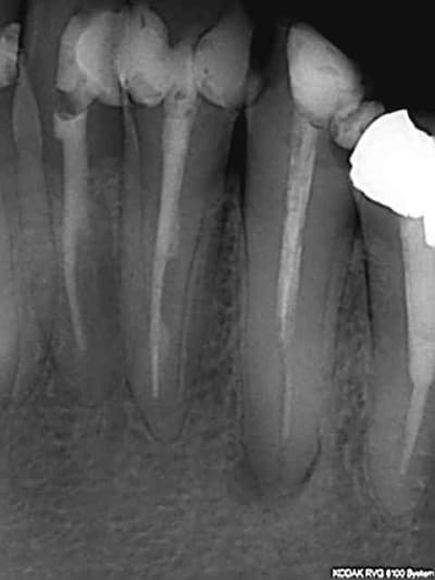 R14 pgc6jj - Eugenol