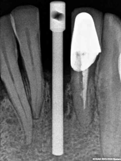 R17 hnbcuo - Eugenol