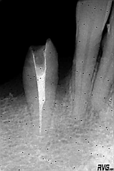 R17 rqwhsh - Eugenol