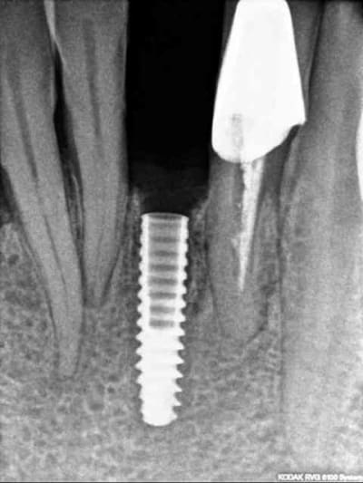 R18 buaqau - Eugenol