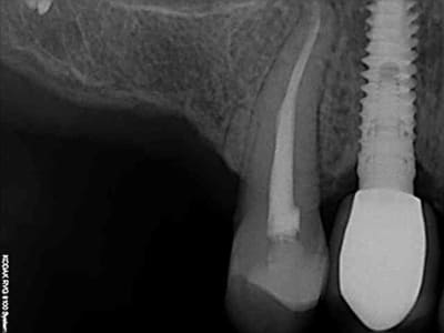 R18 naqzzj - Eugenol