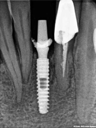 R20 rvxiyf - Eugenol