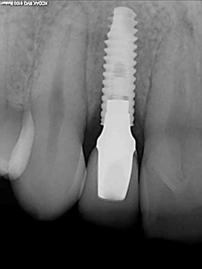 R23 mgmtmn - Eugenol