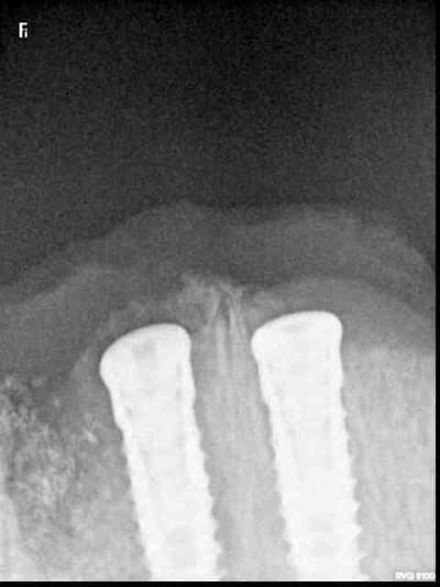 R26 aso1un - Eugenol