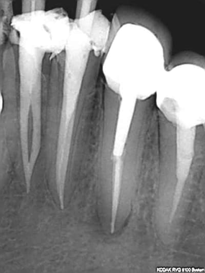 R72 errfkl - Eugenol