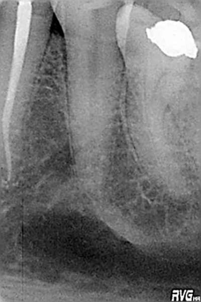 R7 koqeva - Eugenol