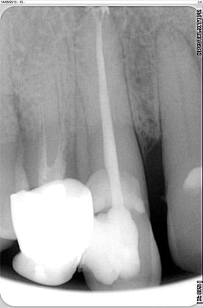 Radio endo oueghe - Eugenol