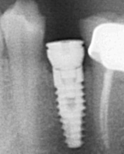 Radio iayqgk - Eugenol