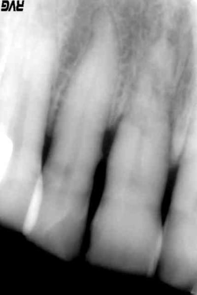 Rbor2 qhgcme - Eugenol