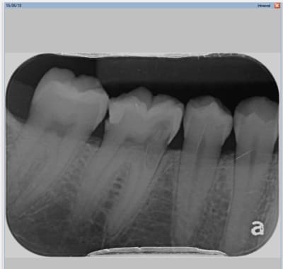 Resorption fagig8 - Eugenol