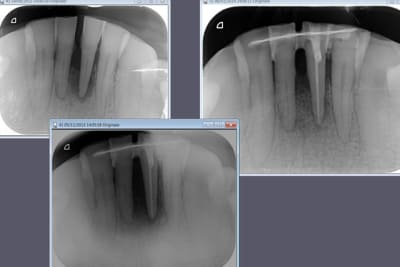 Rog ttqlrq - Eugenol