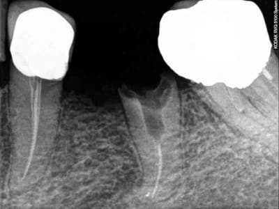 Rx1 nljyfz - Eugenol