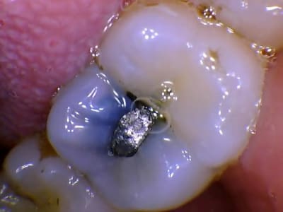Sans titre 34 gbwfkg - Eugenol