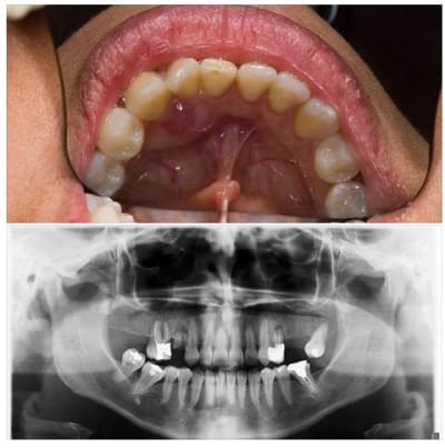 Sans titre a6ph7r - Eugenol