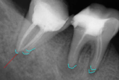 Sans titre is8zr9 - Eugenol