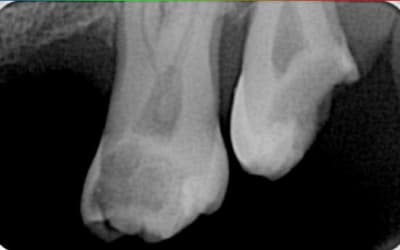 Sans titre mud4zk - Eugenol