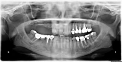 Sans titre n55yez - Eugenol