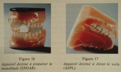 Saos4 ja2juf - Eugenol