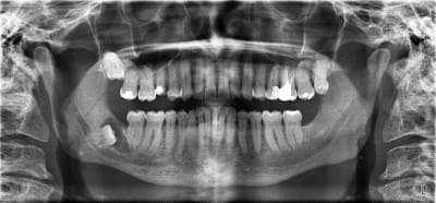 Screenshot002 mueygd - Eugenol