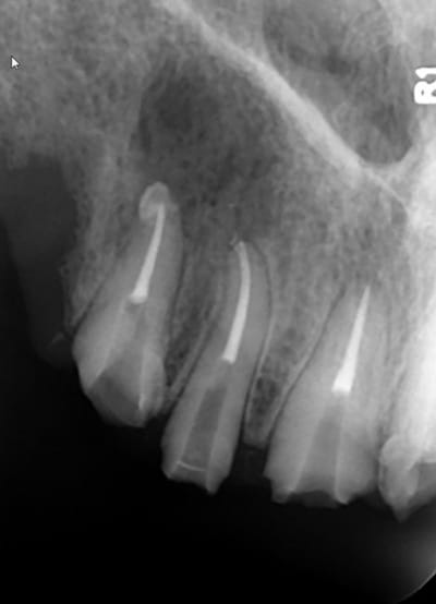 Screenshot109 zmpp3m - Eugenol