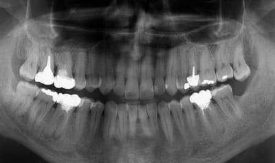 Screenshot119 xzog0u - Eugenol