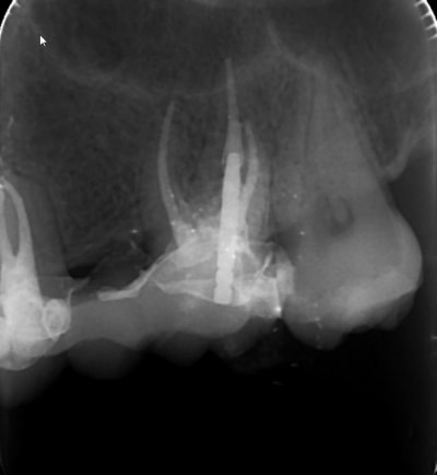 Screenshot334 mjirjy - Eugenol