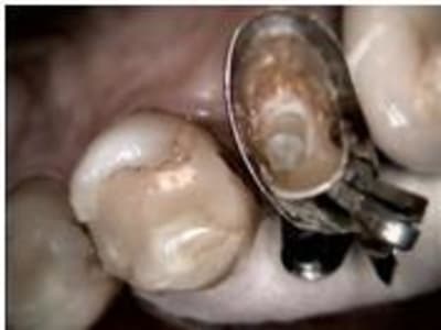 Sem t tulo xik3ke - Eugenol