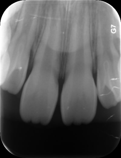 Sent 4164 aelmcg - Eugenol