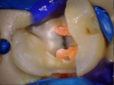 Stillcap0009 zsthm4 - Eugenol