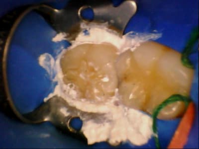 Stillcap0046 acd9gz - Eugenol