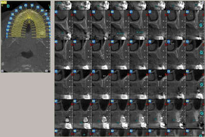 Tallet  michel  sequenceofcrosses shot  2  icjig3 - Eugenol