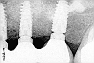 Tekka vyjm5t - Eugenol